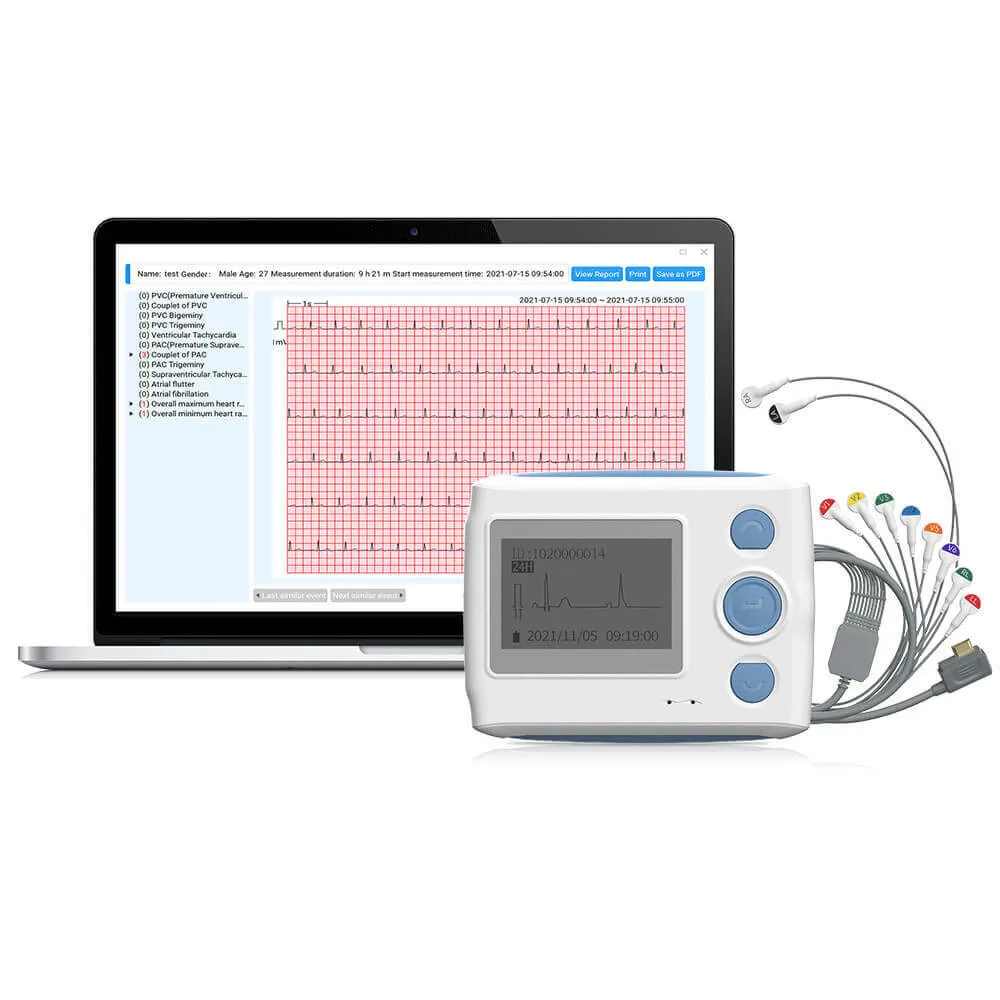 12-Lead Holter Monitor