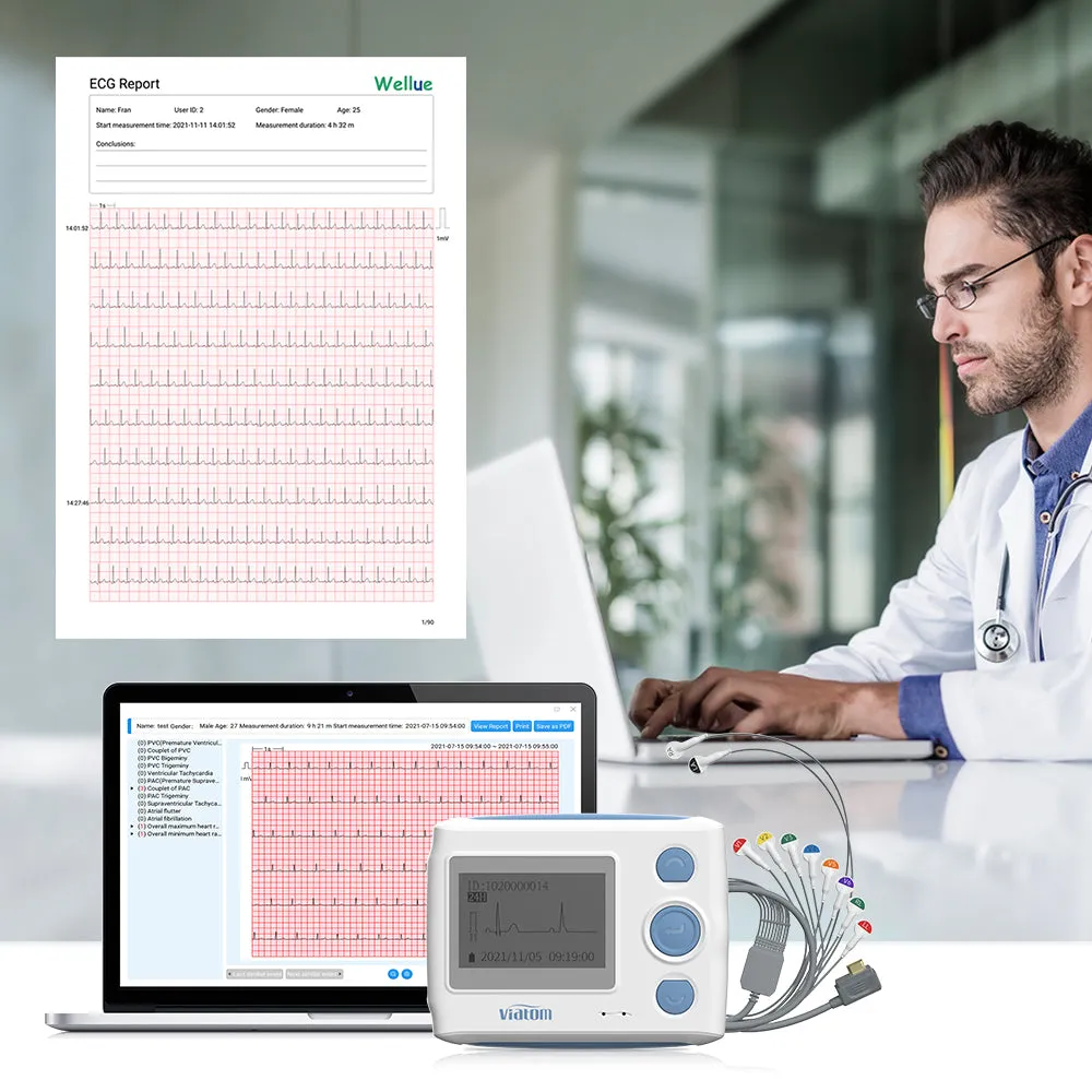 12-Lead Holter Monitor