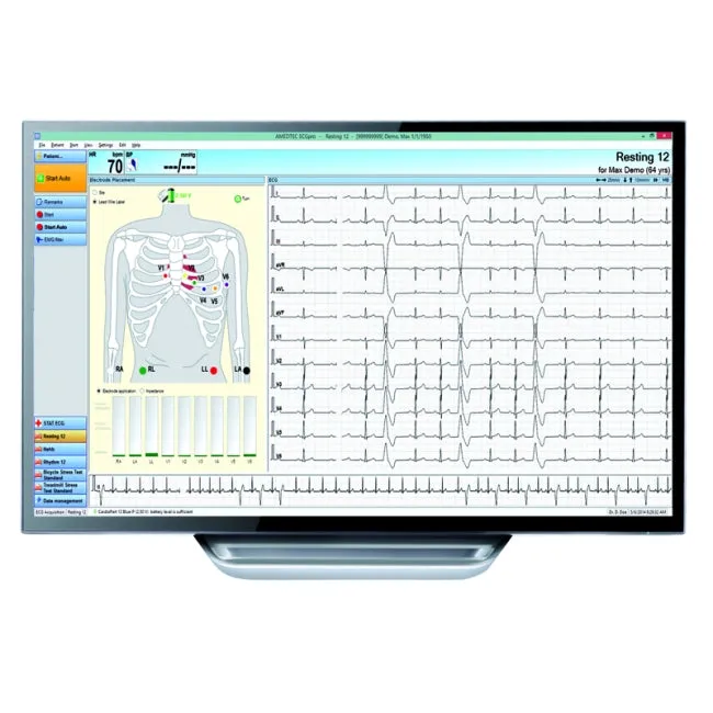 PC Based ECG Machine with 12 Channels